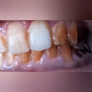 LIFUSHA EELHOE Essence Powder: Solusi Oral Hygiene & Pemutih Gigi