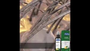 Wake Hair Follicles Anti-hair loss serum rapid growth hair thickening agent men and women hair growth hairline 120ML