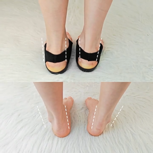 PVD Orthopedic Insoles Flat Foot XO type Leg Correction Shock Absorption Half Pad Support Wearable Shoe Arch Heel Cover