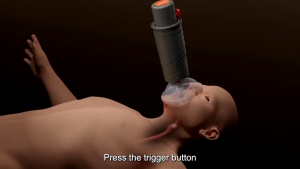 Portable Anti-Choking Emergency Rescue Device 3 Sizes 33KPa Continuous Suction Self Rescue First Aid Tool For Adult Kids