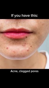 The Ordinary Alpha Arbutin 2% + HA Concentrated Serum 30 ml