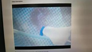 EU/US Standard Pool Vacuum Cleaning Kit Pool Cleaner Brush with Handle Disinfection Suction Head Filter for Swimming Pool