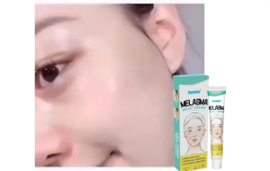 Cream penghilang flek  hitam salep melasma flek Bintik Melasma Penghapusan Whitening Cream salep flek hitam yg asli Anti Aging Keriput Brightening Pelembab Perawatan Kulit
