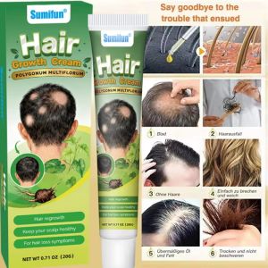 BIOAOUA | Fast Plant Hair Growth Cream Anti Hair Loss Baldness Repair Damaged Scalp Treatment Nourish Hair Root Care Products Women Men