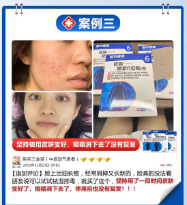 Far Infrared Moisture Dispelling Paste for Navel Protection and Hot Compress Ideal for Home and Home Office Use