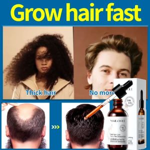 【SG stock】Hair Serum Hair Treatments Hair Loss Prevention and Growth Serum Hair Tonic for Hair Growth Strengthens Hair Roots白黑客防脱育发液60ML