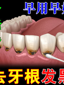 Black Tooth Root Removal Teeth Cleaning Agent Fluoride Spot Removal Dental Care Powder for Stain Removal And Gum Health