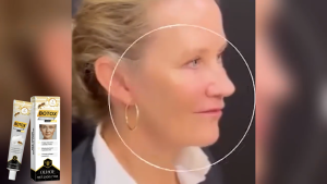 Amz Bee Venom Care Cream Gently Moisturizes and Tightens the Skin  Brightens and Moisturizes the Face  Softens  Smoothes and Hydrates the Face Cream