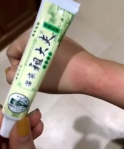 ครีมzdf สูตร Original(หลอดสีเขียว) ขนาด 15 กรัม บำรุงผิวหนังอย่างดีจากจีน Hand Lotion Cream and Scrubs บำรุงผิวหนัง ครีมของแท้จากจีน จบทุกปัญหา ตัวเดียวเอาอยู่