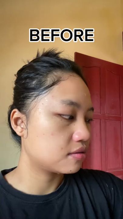 Dr.Leo Perawatan Jerawat 2PCS Kit - Salicylic Acid Acne Treatment Drying Lotion 10mlDr.Leo Salicylic Acid Acne Treatment Drying Lotion 10ml + Amazon White Deep Pores Cleansing & Purifying Clay Mask