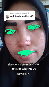 FACIAL WASH ANTI ACNE/ SABUN CUCI MUKA KHUSUS WAJAH BERJERAWAT/ SABUN ACNE PLATINUM