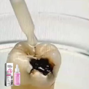 oralhoe | Serum Làm Trắng Răng Từ Thực Vật Tự Nhiên Làm Sạch Sâu Làm Sáng Men Răng Cải Thiện Cảm Giác Thoải Mái Trong Miệng Loại Bỏ Hơi Thở Khó Chịu 30g