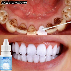 Pemutih gigi Cuci gigi kuning dengan esensi Hapus Kalkulus gigi dan karang gigi Kesehatan mulut Secara efektif hapuskan plak Kotoran Penggunaan sehari-hari