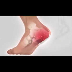 Heel pain patch foot pain joint pain ankle pain 12 patches/box fasciitis bone spurs heel tendinitis relief care patch