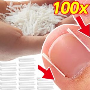 1/20box Invisible Ingrown Toe Nail Treatment Pad Ingrown Toenail Correction Tool Groove Straightening Clip Brace Foot Care2026