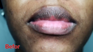 【SG Stock】Lipstick Black Lips Removal 5g Moisturizing Lip Care Lip Lightening Remove Dark Lip Linesdry Cracked