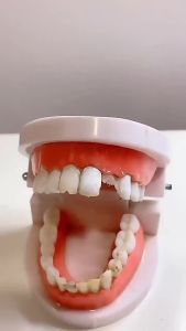 100g Temporary Tooth Repair Resin Beads Solid Adhesive for Gaps Defects DIY Dental Restoration Material Tooth Repair Kit