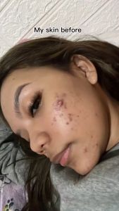 Masker Wajah Penghilang Komedo / Charcoal & Clean Stick Mask - Angkat Komedo & Kontrol Minyak