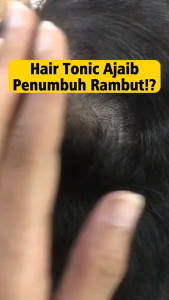 HAIR TONIC MENGATASI RAMBUT RONTOK & KEBOTAKAN FA