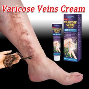 Varicose veins cream Varicose care Essence Ointment 20g Relieve leg vascular bulge varicose veins earthworm leg repair