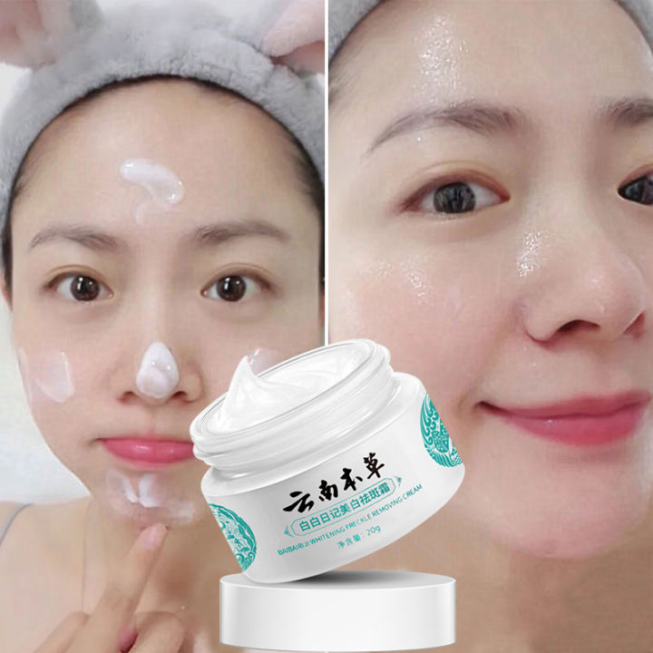 Yunnan Materia Medica Melasma Cream Whitening Freckle Cream Pekas Remover Original Whitening Cream Dark Spots Remover Anti Aging Anti Wrinkle Freckles Removal Cream Moisturizer Bright Lazada PH