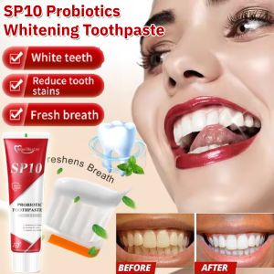 SP10 Probiotics Whitening Toothpaste Plaque And Stain Removal Fresh Breath Inhibits Bacteria Toothpaste Health Tooth Care