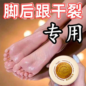 ครีมบำรุงมือและเท้าแห้งรุนแรง TWG ช่วยฟื้นฟู ป้องกันการแยก บำรุง ชุบชื่น สำหรับผิวทุกประเภท ผลิตในจีน