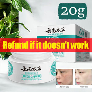 Japanese whitening cream original high moisturizing freckle cream removes chloasma and fades sun spots and age spots