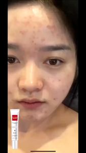 Cream Krim Penghilang Flek Hitam Bintik Noda Hitam Paling Ampuh Whitening Freckle Niacinamide Skin Cream Remove Dark Spots Original Premium Perawatan Wajah