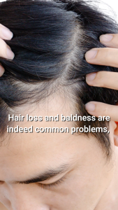 Iyasu Hair Grower 100% Organic ( pro anagen )