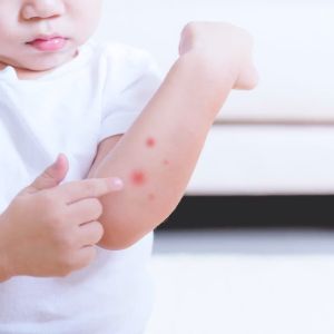 บาล์มออร์แกนิคทาหลังยุง มด แมลงกัด USDA สำหรับเด็ก 3 เดือนขึ้นไป ขนาด 15 g | แพ็คคู่ ING Organic