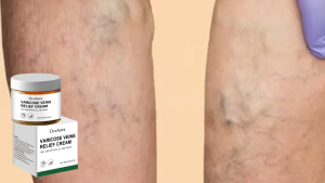 OceAura Varicose Veins Relief Cream Improve Blood Circulation Relieve Legs Dilated Eliminates Vasculitis Phlebitis Ointment 100g