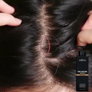 Shampoo Rambut Romtok & Sampo Penumbuh Rambut Cepat