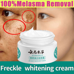 Melasma Remover Cream From Japan Original Whitening face cream High Moisturizing Freckle cream Lighten sunburn spots and age spots