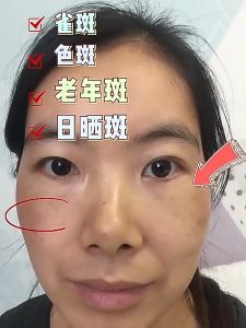 Paket Whitening Cream & Sabun Wajah SISKALEY: 4 Pcs/Set