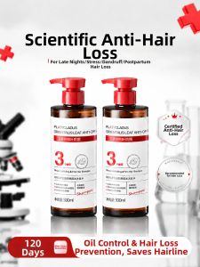 VETES | Anti-Dandruff Oily Scalp Control Volumizing Hair Loss Prevention Shampoo