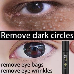 Eye Cream Eye Essence Remove Dark Eye Circle Cream Remover Fine Lines Remover Anti-aging Eye Bags