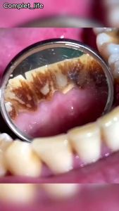 【Upgrade】scoban teeth Whitening toothpaste Peppermint Food Graded Family baking soda Toothpaste