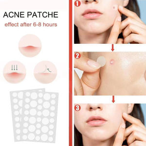 cadia🔥 36 pcs / set Patch Jerawat (Paket Individu) / Patch Penghilang Komedo / Acne Pimple Patch / Penghilang & Stiker Jerawat