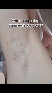 D UA Care Anti-Perspirant Underarm Spray | Deodorant Body Moistener Anti-Pawis at Amoy WHITENING ANDER ARM | SMOTHEN SKIN |ANTI BODY ODOR