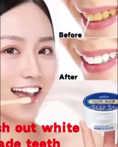 3 Days Teeth Whitening Probiotic Tooth Powder Cleans Teeth Fresh Breath Removes Tooth Stains And Plaque Oral Care Removes Bad Breath Smoke Whitens Teeth Oral Hygiene Removes Yellow Tooth Stains Bleaching Tooth Powder 50g