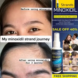 Strands 6% Minoxidil Topical Solution(60ml bottle)Hair beard eyebrow Hair growers Anti Hair Loss 4.7 1.9K ratings 9.3K Sold