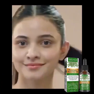 KADAIE Eelhoe Rosemary Oil Rambut Penumbuh Rambut Botak Perawatan Rambut Rontok Penumbuh Rambut Cepat Hair Growth Oil Untuk Rambut Rontok