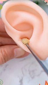 ชุดไม้แคะหู ไม้แคะหู ชุดไม้แคะหู ไม้ปั่นหู ชุดแคะหูแสตนเลส6ชิ้น มัลติฟังก์ชั่น กระทัดรัด พกพาสะดวก