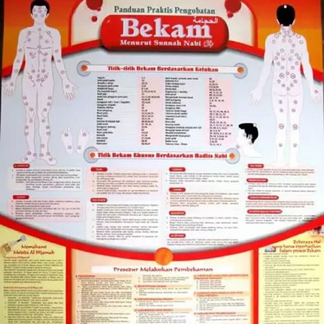 Poster Bekam Poster Titik Penyakit Bekam | Lazada Indonesia