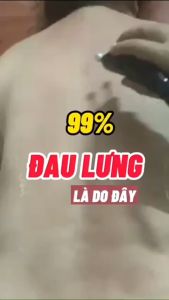 Bọ Cạp Bạc Ta Chuẩn Diện Chẩn Cao Cấp - Dụng Cụ Diện Chẩn