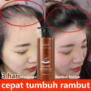 Shampo Penumbuh Rambut Shampo Penumbuh Rambut Cepat 500ml Ekstrak He Shou Wu dan Jahe Mencegah Rambut Rontok Mencegah Rambut Rontok. Rambut rontok pascapersalinan rambut rontok seboroik/