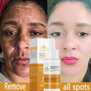 Powerful Dark Spots Remover Whitening Serum Face Freckle Melanin Correcting Anti Pigmentation Brighten Skin Beauty Care Products2026