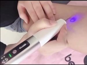 Laser Plasma Pen Wart Remover Black Dots Freckle Mole Dark Spot Remover Plasma Pen Wart Eliminator Papilloma Skin Tag Removal