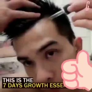 Serum Penumbuh Rambut Penumbuh Rambut Cepat dan Tebal Serum Rosemary Oil Hair Oil Rambut Rontok Penumbuh Rambut Botak Hair Growth Serum Hair Treatment Minyak Esensial Perawatan Rambut Rontok Rambut Rusak-💖Uiabgt